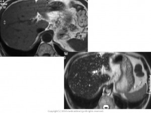 201405 VMC key image MRI
