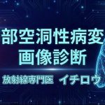 保護中: 空洞性病変の画像診断